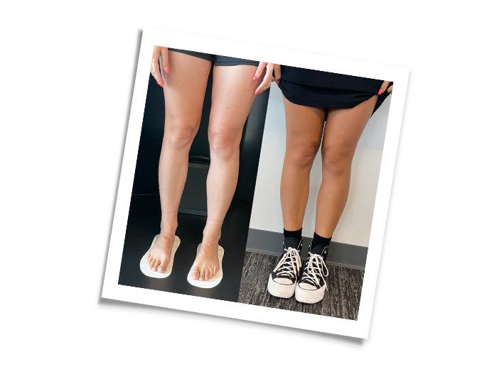 rebalance-before-after